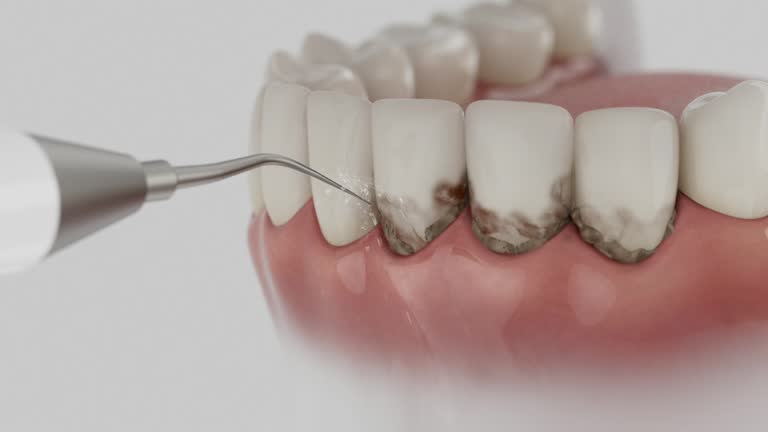 Trusted Tooth Extraction service in Wolcottville, IN - Dentist Open Now